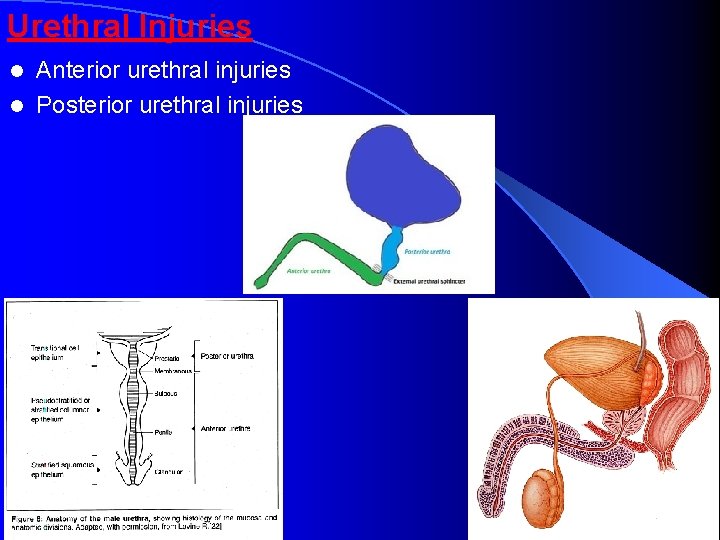 Urethral Injuries Anterior urethral injuries l Posterior urethral injuries l 