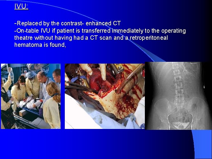 IVU: -Replaced by the contrast- enhanced CT -On-table IVU if patient is transferred immediately