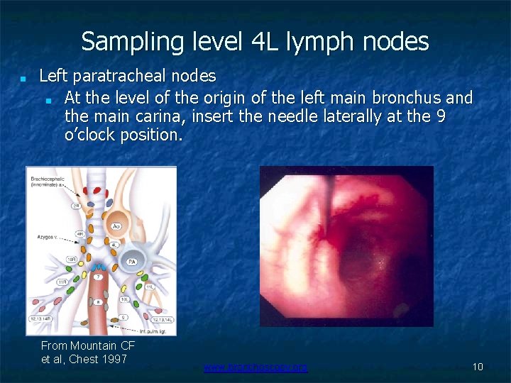 Sampling level 4 L lymph nodes ■ Left paratracheal nodes ■ At the level
