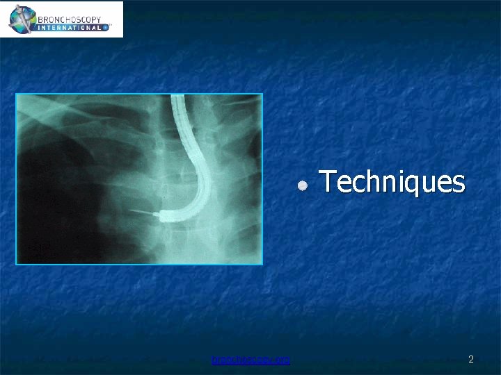 Techniques bronchoscopy. org 2 