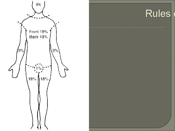 Rules o 