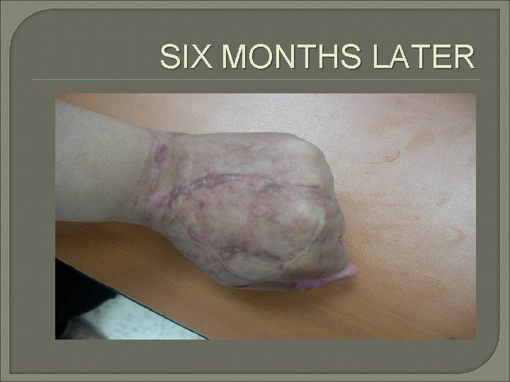 SIX MONTHS LATER 