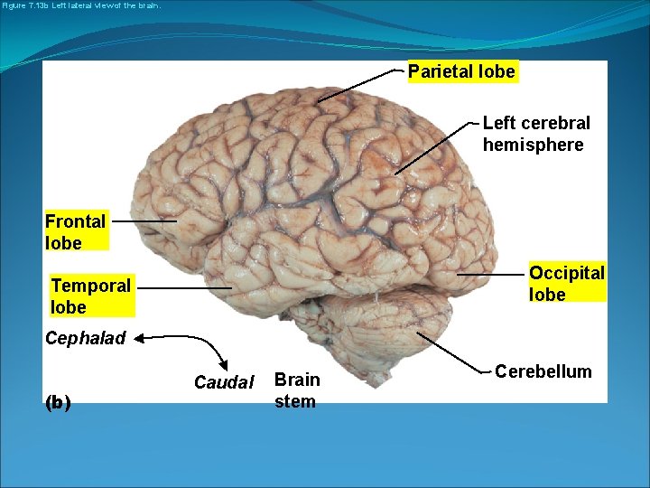 Figure 7. 13 b Left lateral view of the brain. Parietal lobe Left cerebral