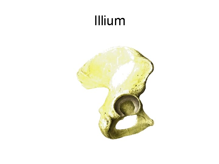 Illium 