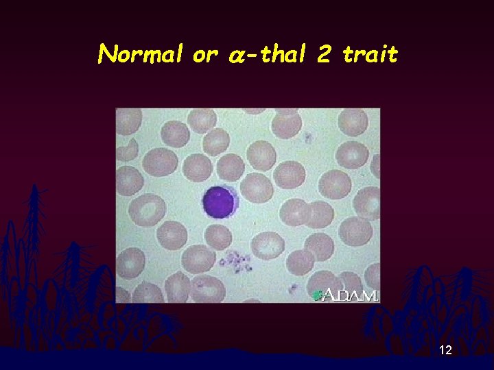 Normal or a-thal 2 trait 12 