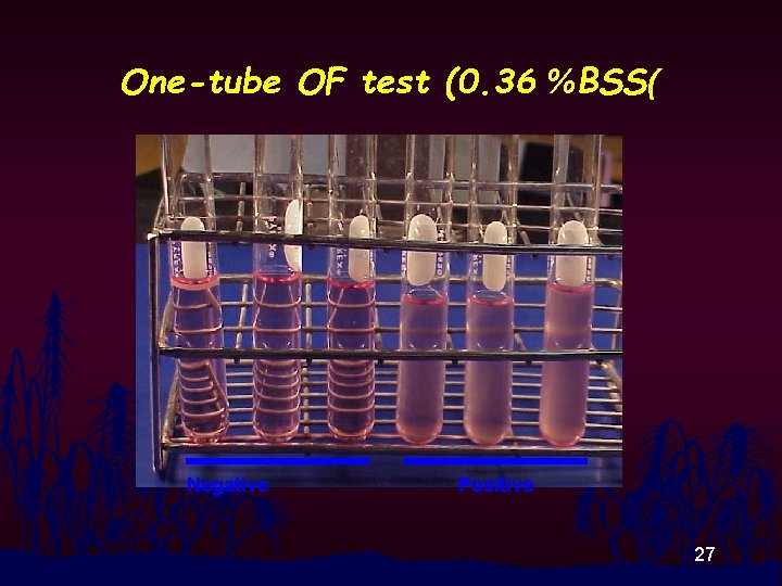 One-tube OF test (0. 36 %BSS( Negative Positive 27 