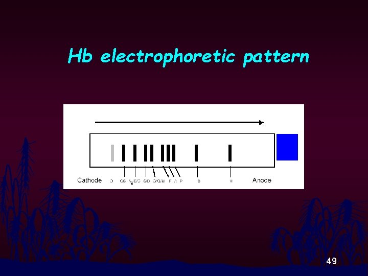 Hb electrophoretic pattern 49 