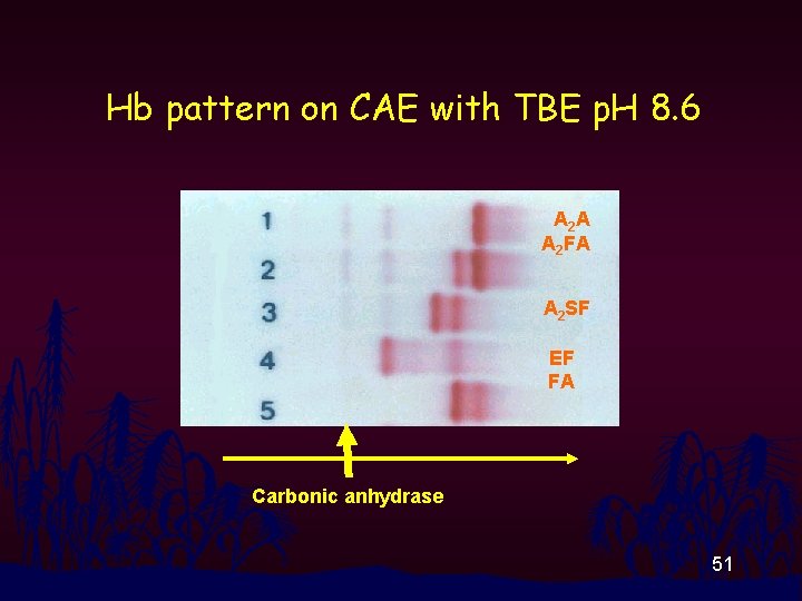 Hb pattern on CAE with TBE p. H 8. 6 A 2 A A
