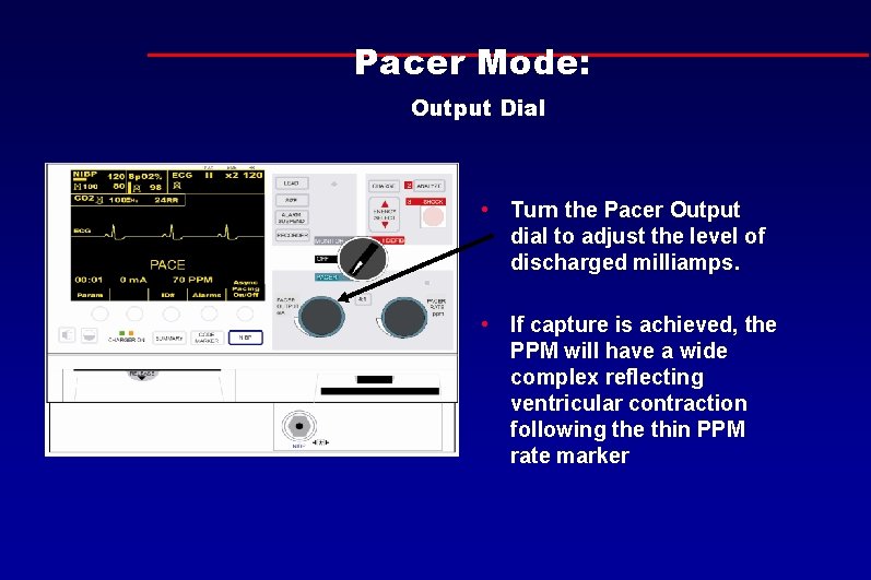 Pacer Mode: Output Dial • Turn the Pacer Output dial to adjust the level