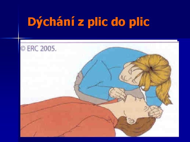 Dýchání z plic do plic 1. Záklon hlavy 2. Ucpat nos a vdech v