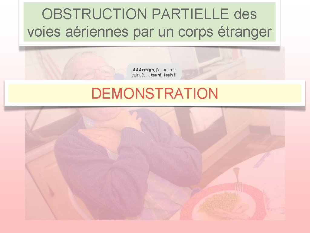 OBSTRUCTION PARTIELLE des voies aériennes par un corps étranger AAArrrrgh, j’ai un truc coincé.