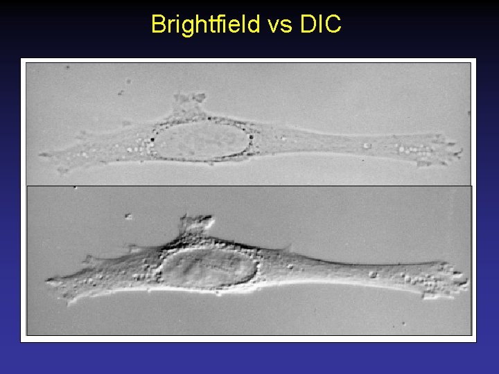 Brightfield vs DIC 