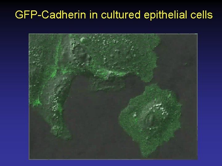 GFP-Cadherin in cultured epithelial cells 