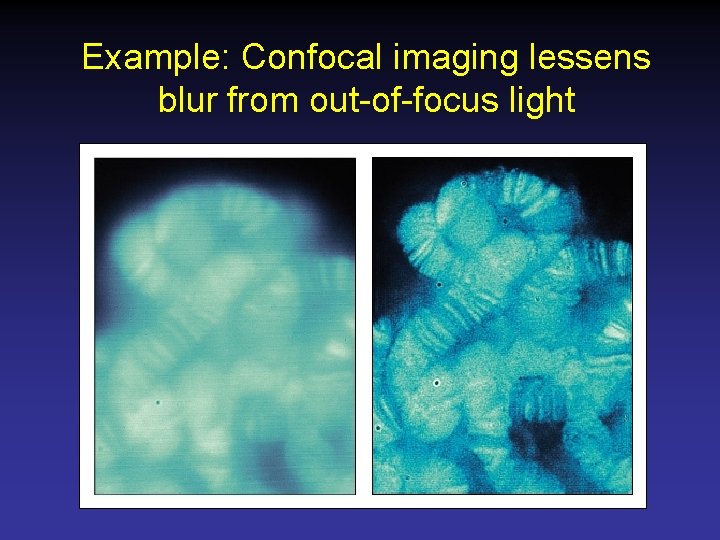 Example: Confocal imaging lessens blur from out-of-focus light 