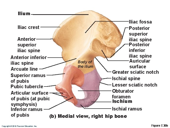 Ilium Iliac crest Iliac fossa Posterior superior iliac spine Posterior inferior iliac spine Auricular