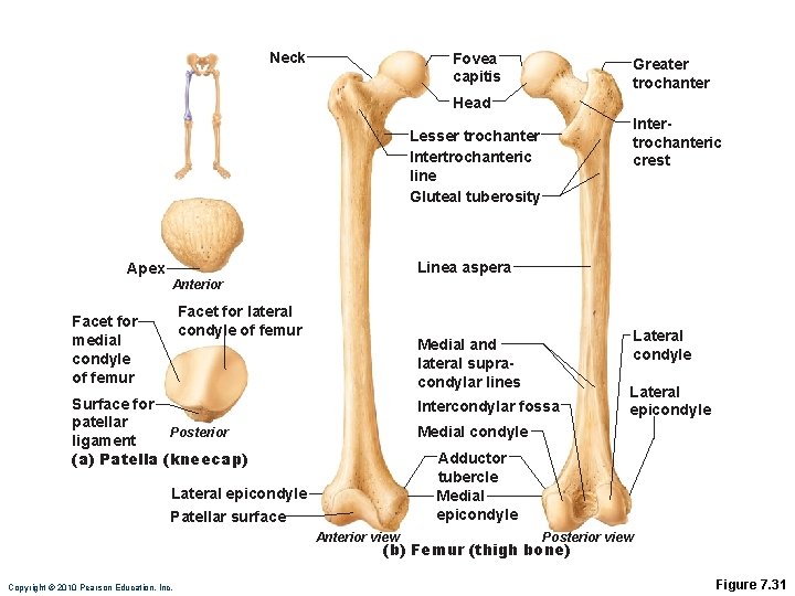Neck Fovea capitis Greater trochanter Head Intertrochanteric crest Lesser trochanter Intertrochanteric line Gluteal tuberosity Neck Fovea capitis Greater trochanter Head Intertrochanteric crest Lesser trochanter Intertrochanteric line Gluteal tuberosity