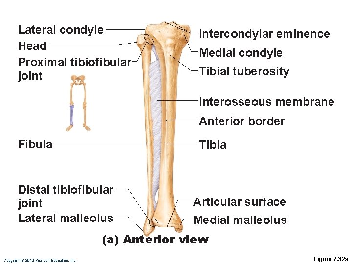 Lateral condyle Head Proximal tibiofibular joint Intercondylar eminence Medial condyle Tibial tuberosity Interosseous membrane Lateral condyle Head Proximal tibiofibular joint Intercondylar eminence Medial condyle Tibial tuberosity Interosseous membrane