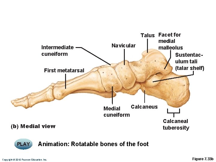 Intermediate cuneiform First metatarsal Talus Facet for medial Navicular malleolus Sustentaculum tali (talar shelf) Intermediate cuneiform First metatarsal Talus Facet for medial Navicular malleolus Sustentaculum tali (talar shelf)