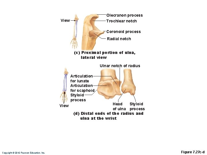 Olecranon process Trochlear notch View Coronoid process Radial notch (c) Proximal portion of ulna, Olecranon process Trochlear notch View Coronoid process Radial notch (c) Proximal portion of ulna,
