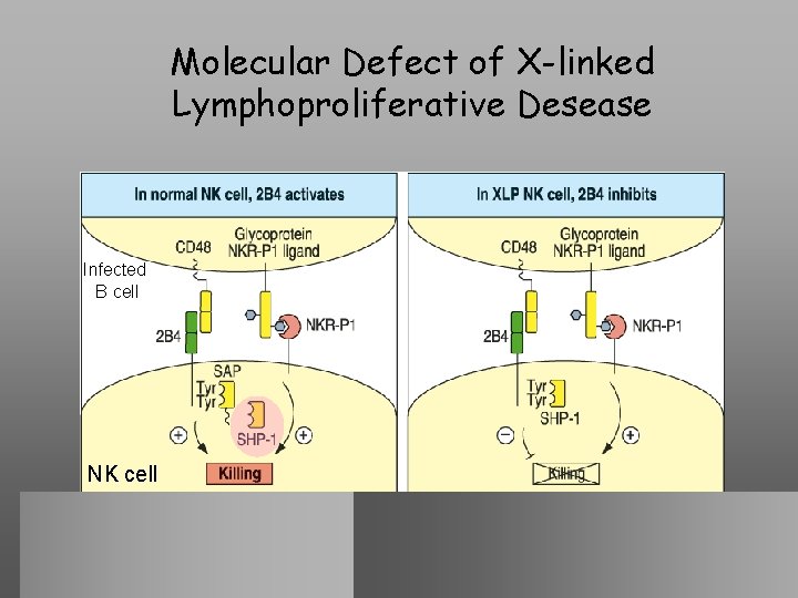 Molecular Defect of X-linked Lymphoproliferative Desease Infected B cell NK cell 