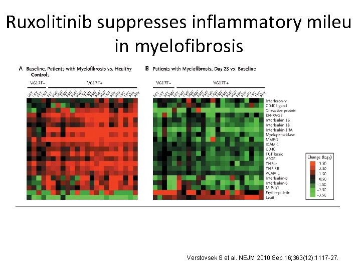 Ruxolitinib suppresses inflammatory mileu in myelofibrosis Verstovsek S et al. NEJM 2010 Sep 16;
