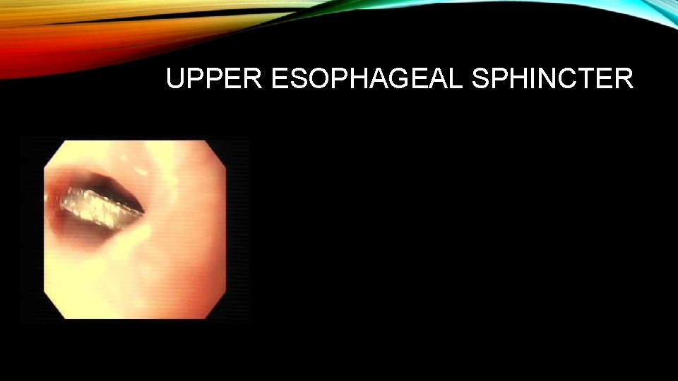 UPPER ESOPHAGEAL SPHINCTER 