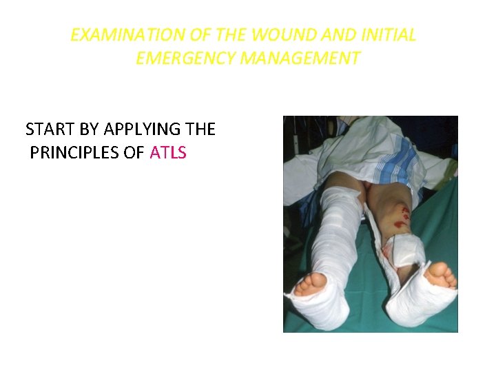 EXAMINATION OF THE WOUND AND INITIAL EMERGENCY MANAGEMENT START BY APPLYING THE PRINCIPLES OF