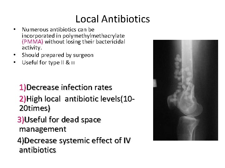 Local Antibiotics • Numerous antibiotics can be incorporated in polymethylmethacrylate (PMMA) without losing their