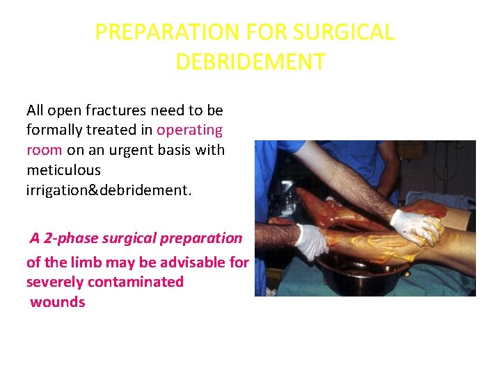 PREPARATION FOR SURGICAL DEBRIDEMENT All open fractures need to be formally treated in operating