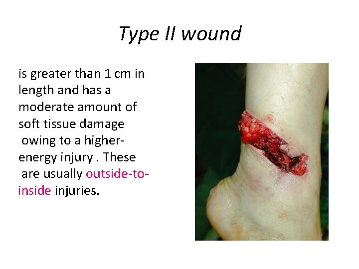 Type II wound is greater than 1 cm in length and has a moderate