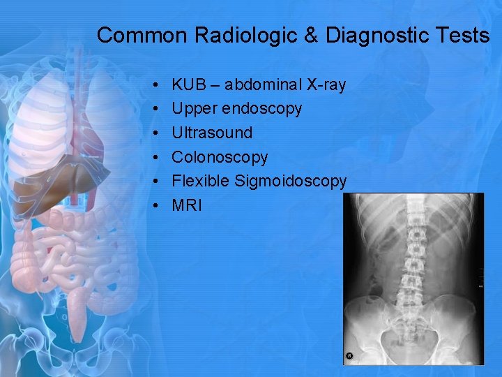 Common Radiologic & Diagnostic Tests • • • KUB – abdominal X-ray Upper endoscopy