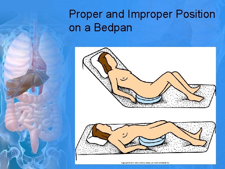 Proper and Improper Position on a Bedpan 