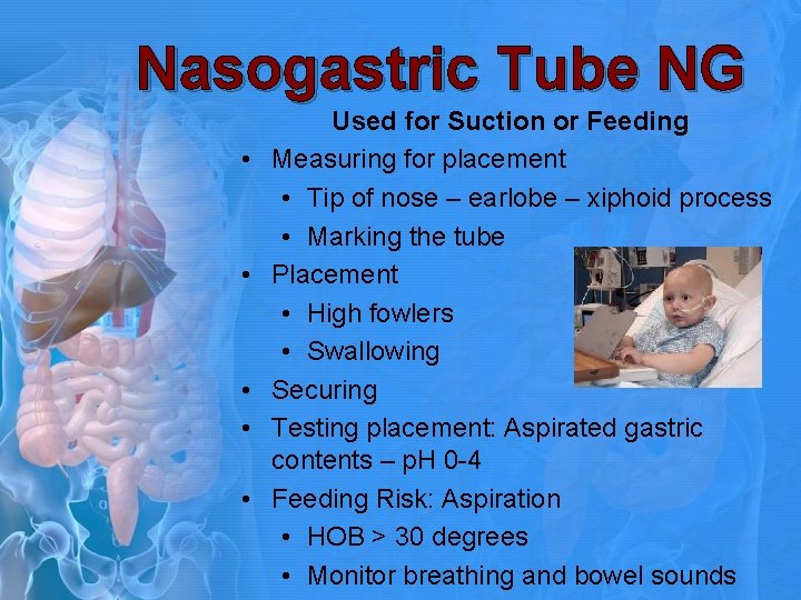 Nasogastric Tube NG • • • Used for Suction or Feeding Measuring for placement