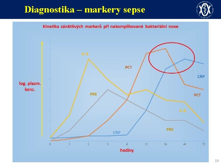 Diagnostika – markery sepse 19 