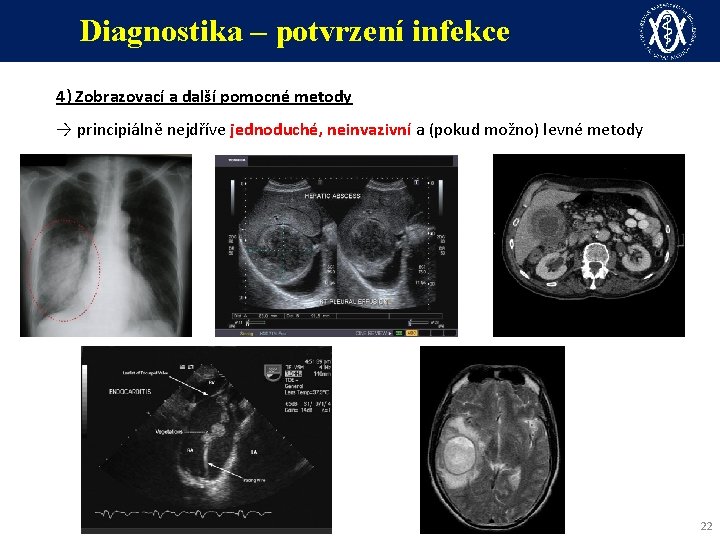 Diagnostika – potvrzení infekce 4) Zobrazovací a další pomocné metody → principiálně nejdříve jednoduché,