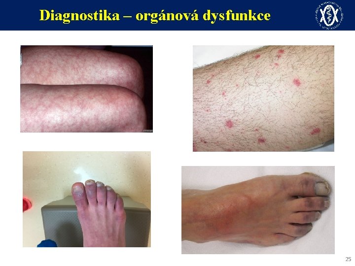 Diagnostika – orgánová dysfunkce 25 