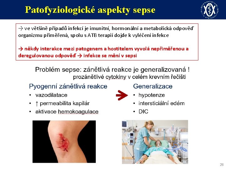 Patofyziologické aspekty sepse → ve většině případů infekcí je imunitní, hormonální a metabolická odpověď