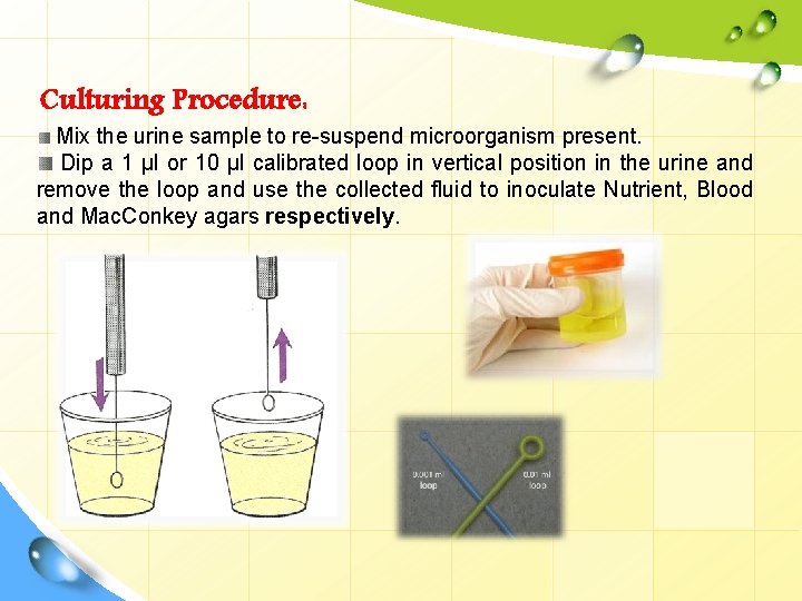 Urine culture LOGO Diagnostic Medical MicrobiologyLaboratory Manual Routine