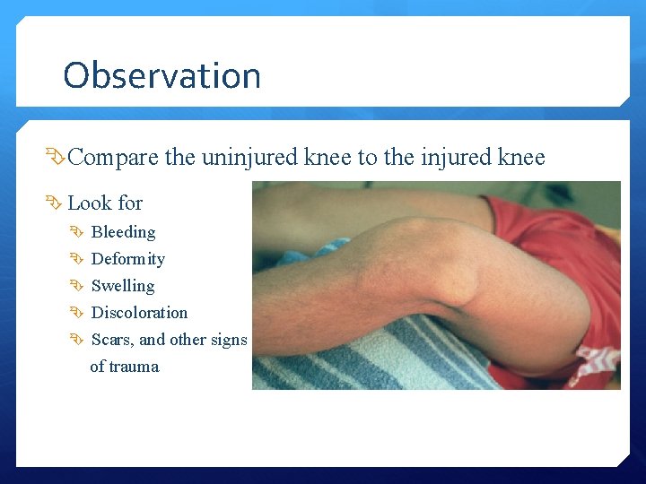 Observation Compare the uninjured knee to the injured knee Look for Bleeding Deformity Swelling