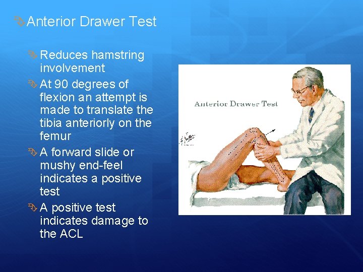  Anterior Drawer Test Reduces hamstring involvement At 90 degrees of flexion an attempt