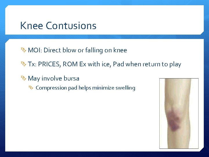 Knee Contusions MOI: Direct blow or falling on knee Tx: PRICES, ROM Ex with