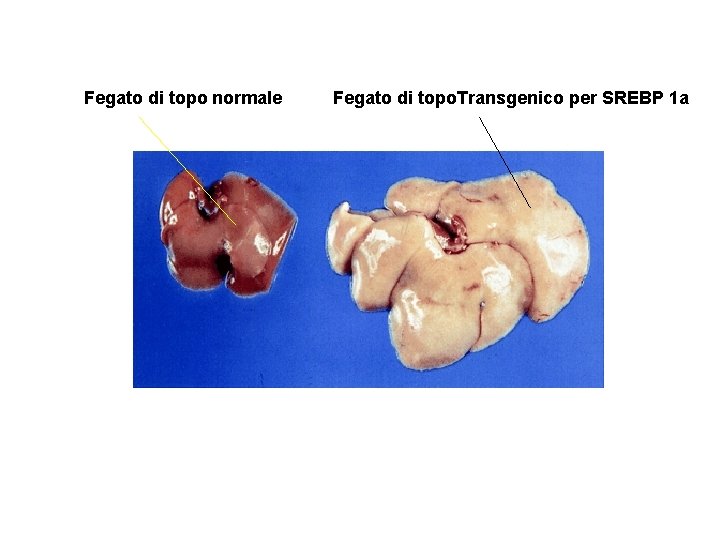 Fegato di topo normale Fegato di topo. Transgenico per SREBP 1 a 