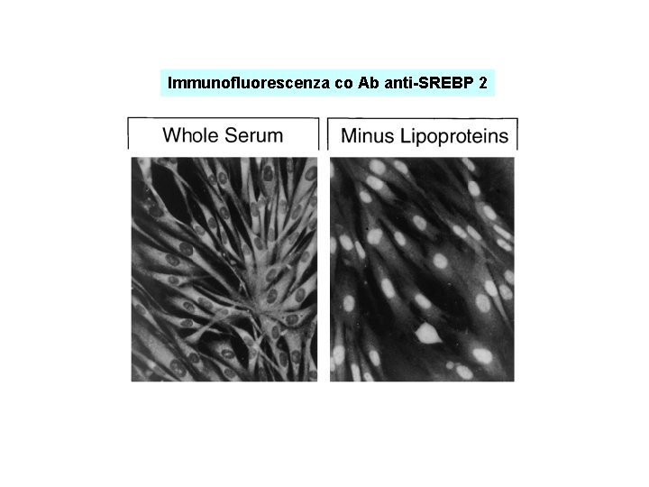 Immunofluorescenza co Ab anti-SREBP 2 