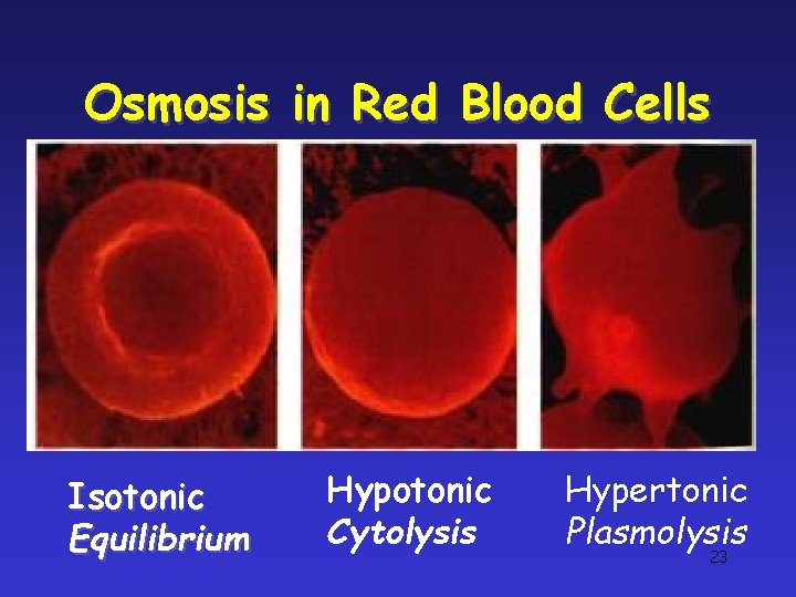 Osmosis in Red Blood Cells Isotonic Equilibrium Hypotonic Cytolysis Hypertonic Plasmolysis 23 Osmosis in Red Blood Cells Isotonic Equilibrium Hypotonic Cytolysis Hypertonic Plasmolysis 23