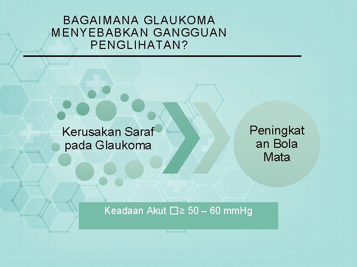 BAGAIMANA GLAUKOMA MENYEBABKAN GANGGUAN PENGLIHATAN? Kerusakan Saraf pada Glaukoma Peningkat an Bola Mata Keadaan