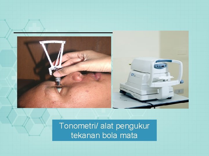 Tonometri/ alat pengukur tekanan bola mata 