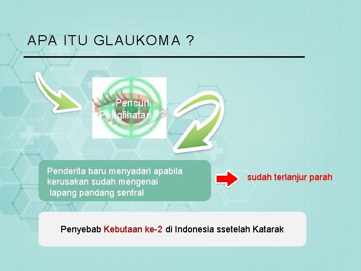 APA ITU GLAUKOMA ? Pencuri Penglihatan ? ? Penderita baru menyadari apabila kerusakan sudah