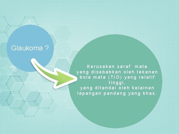 Glaukoma ? Kerusakan saraf mata yang disebabkan oleh tekanan bola mata (TIO) yang relatif