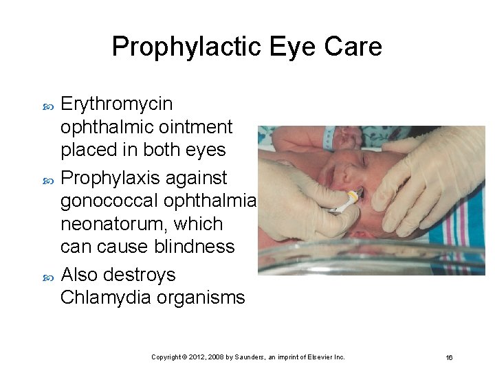 Prophylactic Eye Care Erythromycin ophthalmic ointment placed in both eyes Prophylaxis against gonococcal ophthalmia