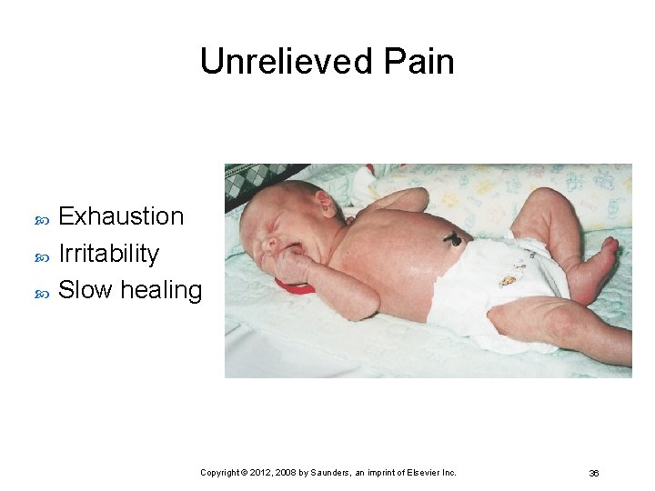 Unrelieved Pain Exhaustion Irritability Slow healing Copyright © 2012, 2008 by Saunders, an imprint